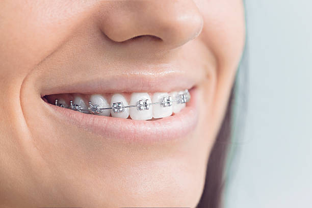 Best Invisalign and Clear Aligners  in Harvey, LA